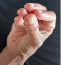 rizartrosis.jpg.jpg